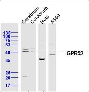 GPR52 antibody
