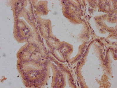 GPR55 antibody