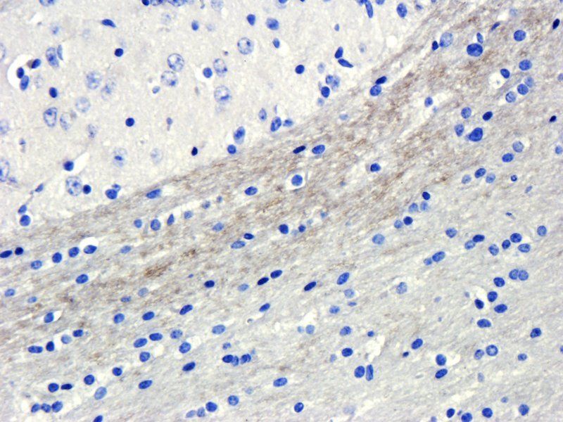 GPR55 antibody