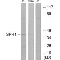 GPR68 antibody