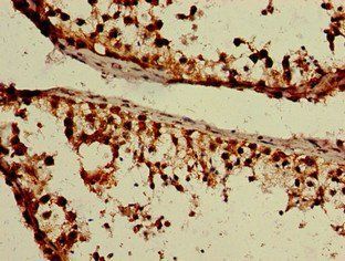 GPR85 Antibody
