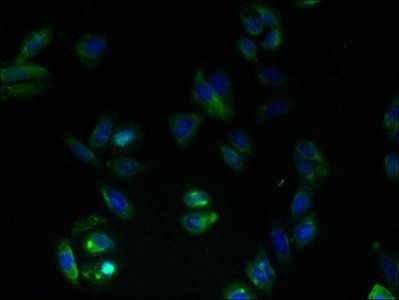 GPRC5B antibody