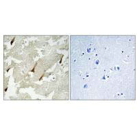 GPRIN2 Antibody