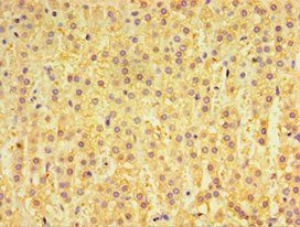 GPS1 Antibody
