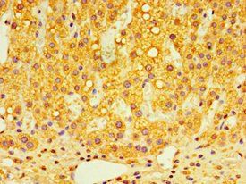 GPS1 Antibody