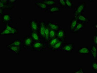 GPS2 Antibody