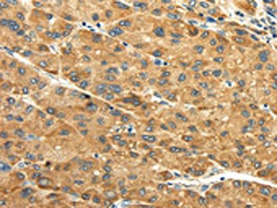 GPT Antibody