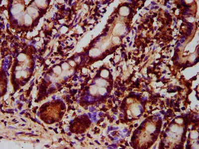 GPT2 Antibody