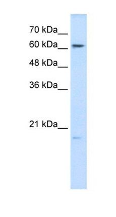 GPX3 antibody
