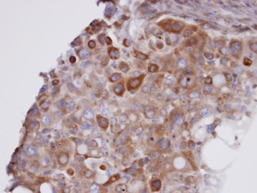 GPX7 Rabbit Polyclonal Antibody