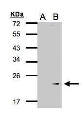 GPX7 Rabbit Polyclonal Antibody