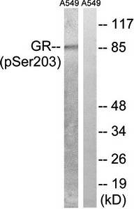 Glucocorticoid Receptor (phospho-Ser203) antibody