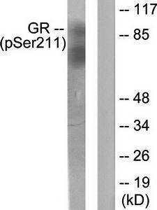 Glucocorticoid Receptor (phospho-Ser211) antibody