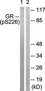 Glucocorticoid Receptor (phospho-Ser226) antibody