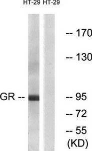 Glucocorticoid Receptor antibody