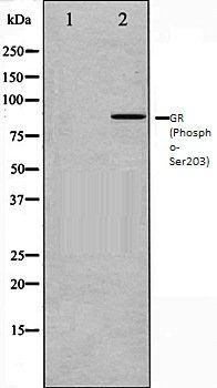 Glucocorticoid Receptor (Phospho-Ser203) antibody