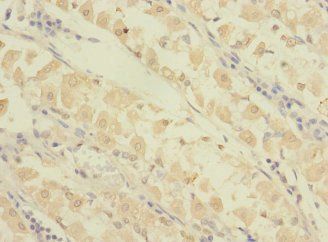 GRAMD1B Antibody