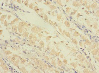 GRAMD1B antibody