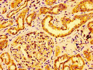 GRB14 Antibody