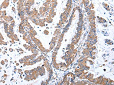 GRB14 Antibody