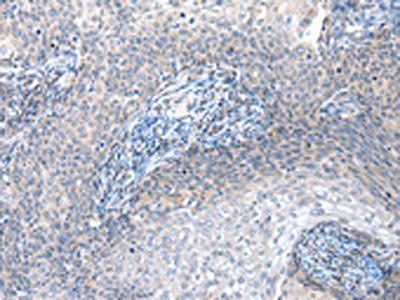 GRB14 Antibody