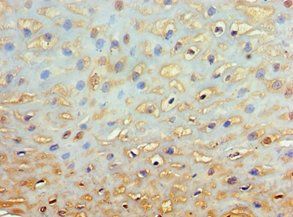 GRB7 Antibody