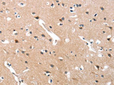 GRB7 Antibody