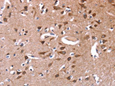 GREB1 Antibody