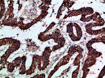 GREM2 antibody