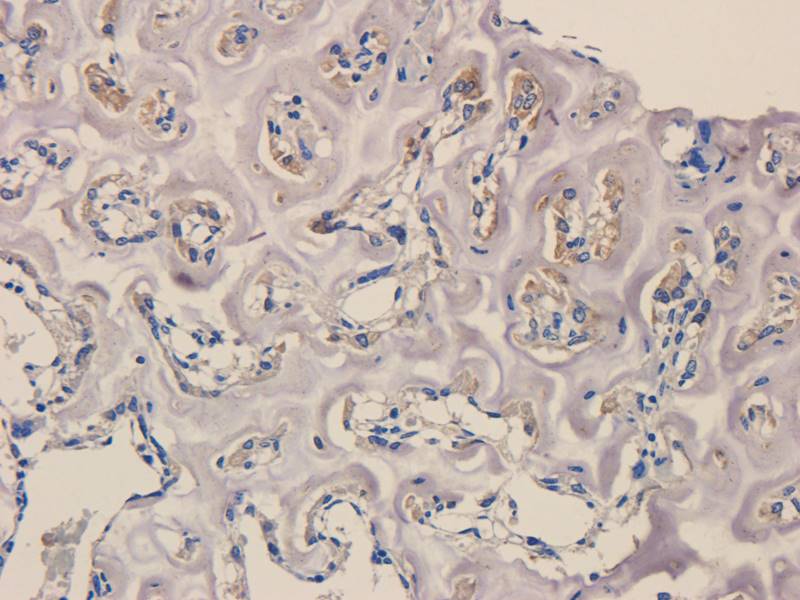 Gremlin 1 antibody