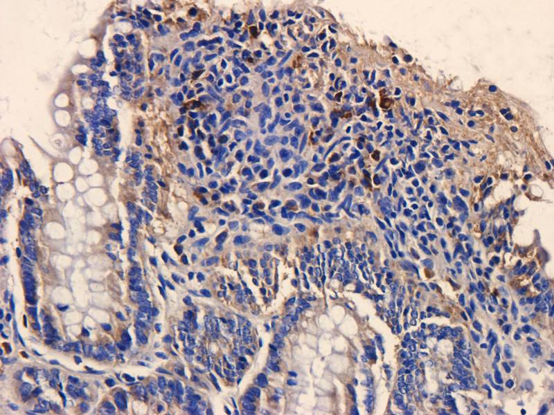 Gremlin 1 Rabbit Polyclonal Antibody