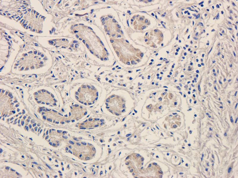 Gremlin 1 Rabbit Polyclonal Antibody