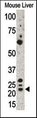 Gremlin 1 antibody