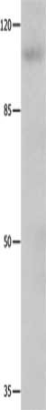 GRIA1 Antibody