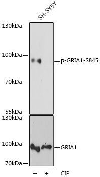 GRIA1 (Phospho-S845) antibody