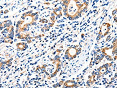 GRIA2 antibody