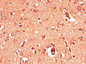 GRIA4 Antibody