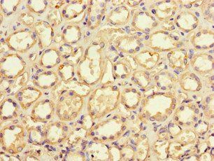 GRID2IP Antibody