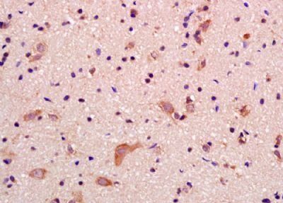 GRID2IP Rabbit Polyclonal Antibody