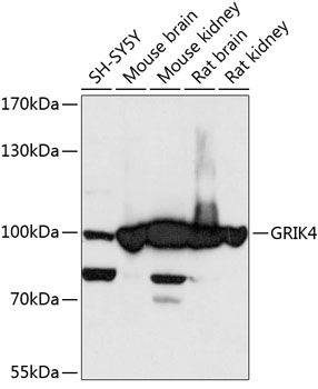 GRIK4 antibody