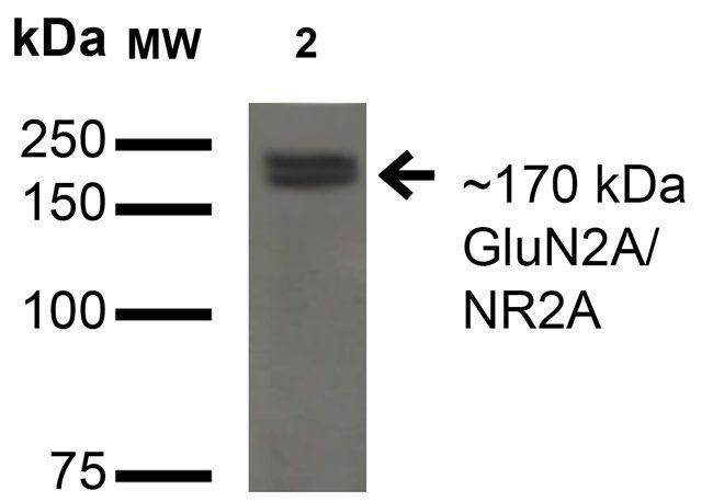 NR2A Antibody
