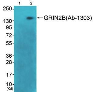 GRIN2B antibody