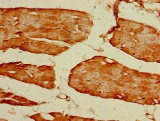 GRIN2C Antibody