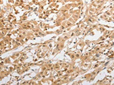 GRIN2C Antibody