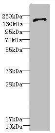 GRIN2D Antibody