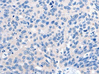 GRIN2D Antibody