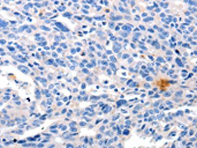 GRIN2D Antibody