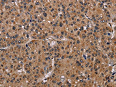 GRK1 Antibody