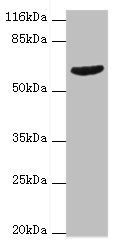 GRK4 antibody