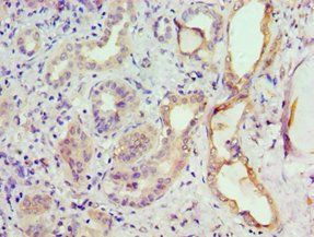 GRK6 Antibody